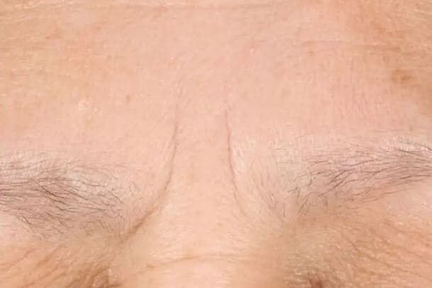 After custom facial treatment showing refreshed, brighter, hydrated skin in Louisville