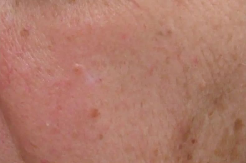 After custom facial treatment showing refreshed, brighter, hydrated skin in Louisville
