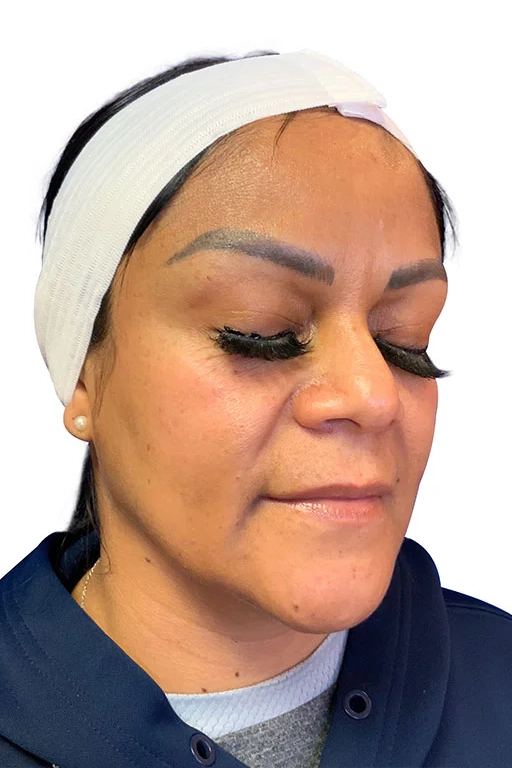 After ToxBooster treatment showing smoother wrinkles and brighter, more even skin in Louisville